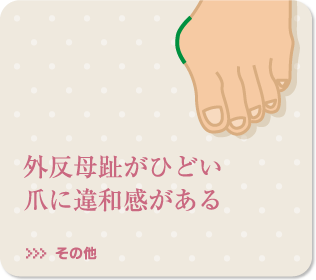 外反母趾がひどい爪に違和感がある